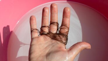 How Much Hair Loss After Shower Is Normal